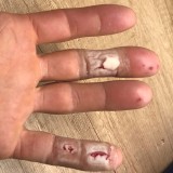 That is why Sigi had to grit his teeth while climbing